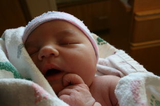 怀孕妊娠合并新生儿假假性甲状旁腺功能减退症怎么观察 怀孕妊娠合并新生儿假假性甲状旁腺功能减退症怎么观察